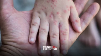 Brote de virus Coxsackie afecta escuelas en Puebla